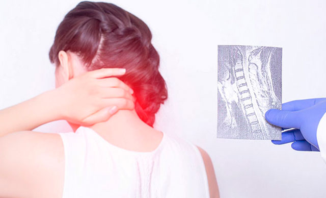 Baş ve omuz ağrısı beyincik sarkmasının belirtisi olabilir